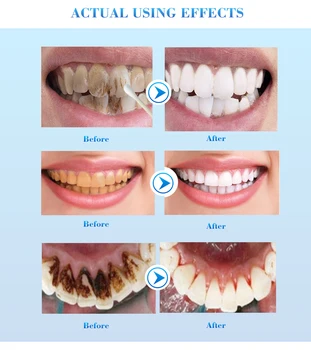 PUTIMI Mutes Higiēnu Zobu Balināšanas Būtību Mutes dobuma Tīrīšana Zobu Seruma Efektīvu Traipu Aplikuma Noņemšana Zobu Želeja Whitener