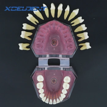 1gb Zobu Mīkstā Gumija Standarta Typodont Studiju Modelis ar 28pcs Izņemamas Zobu Modeli, Zobārstniecības Piederumi